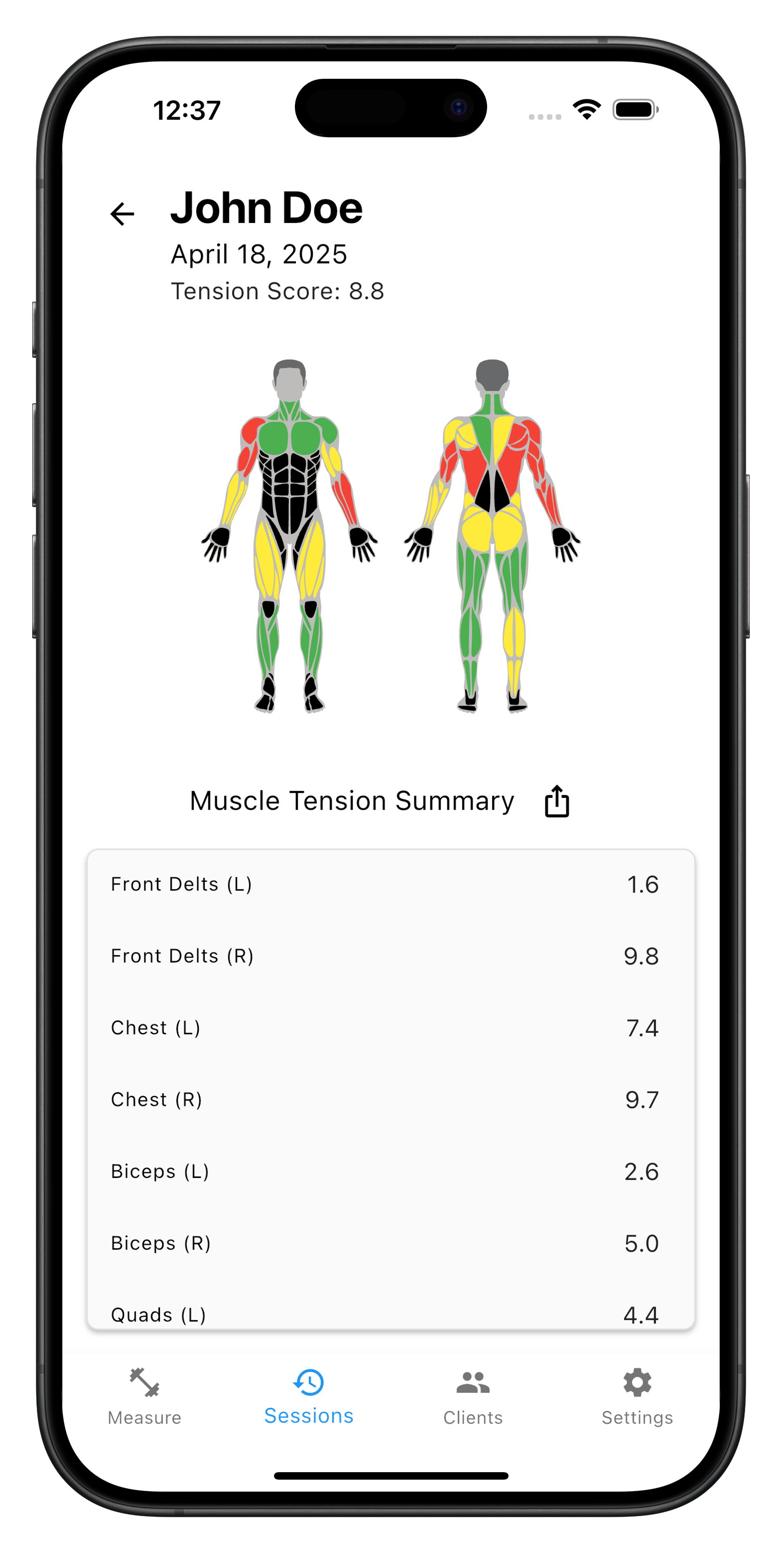 Before/After session