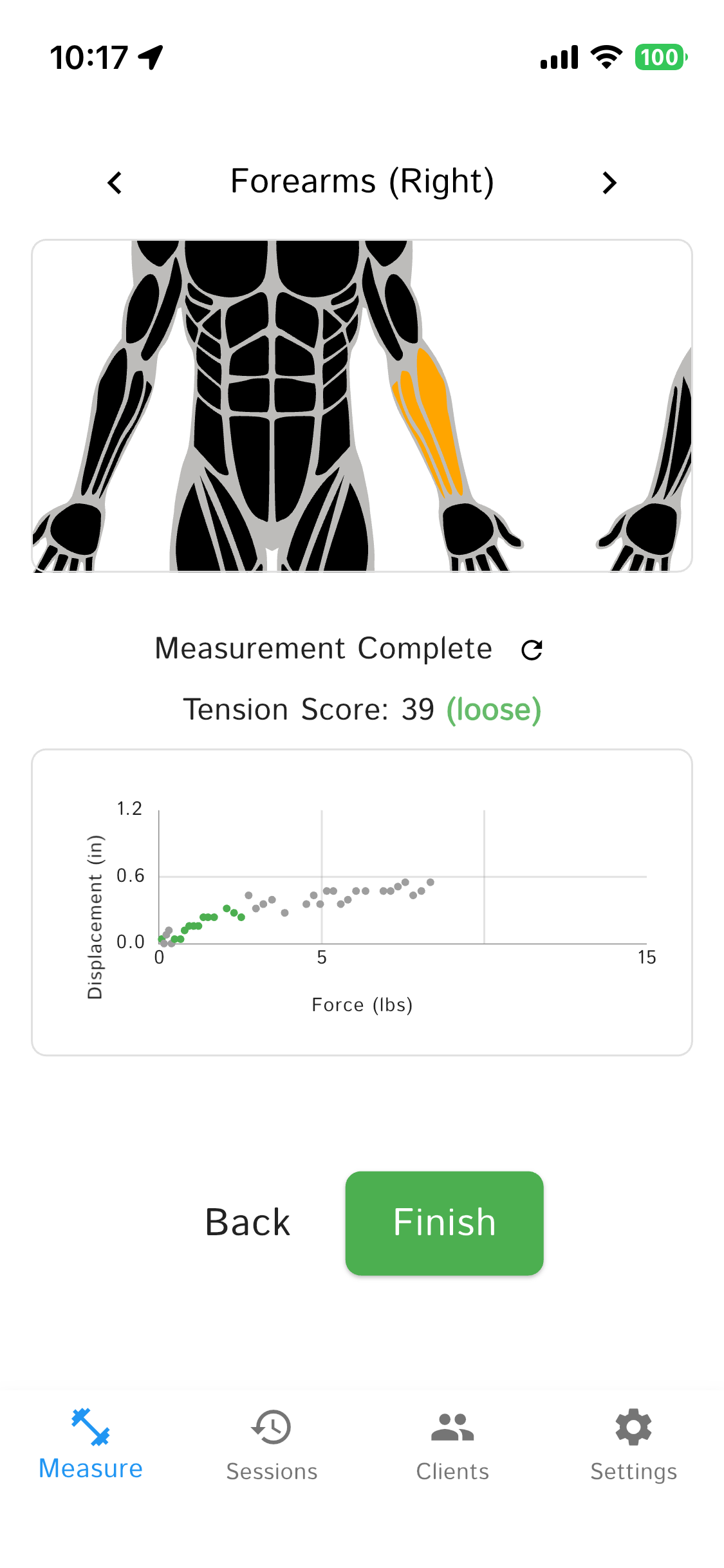 Wall detection example showing green dots for muscle tissue and gray dots for wall contact